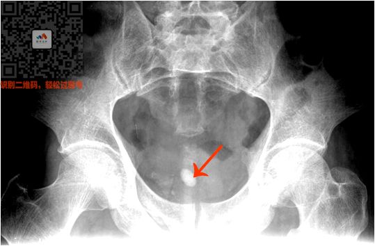 执医技能：X线阅片，全是套路，超简单