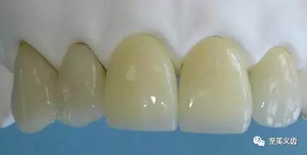 德国的二氧化锆义齿,义齿氧化锆打磨流程及数据