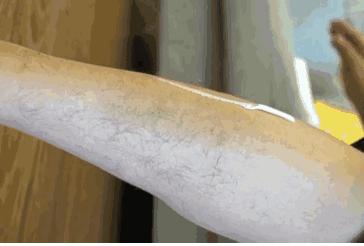 天津小白楼的神店！脱毛后瞬间白2度，原来女神夏天都……