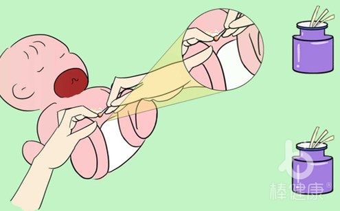 新生儿脐炎一直有黄水流出,新生儿肚脐红肿流水怎么办