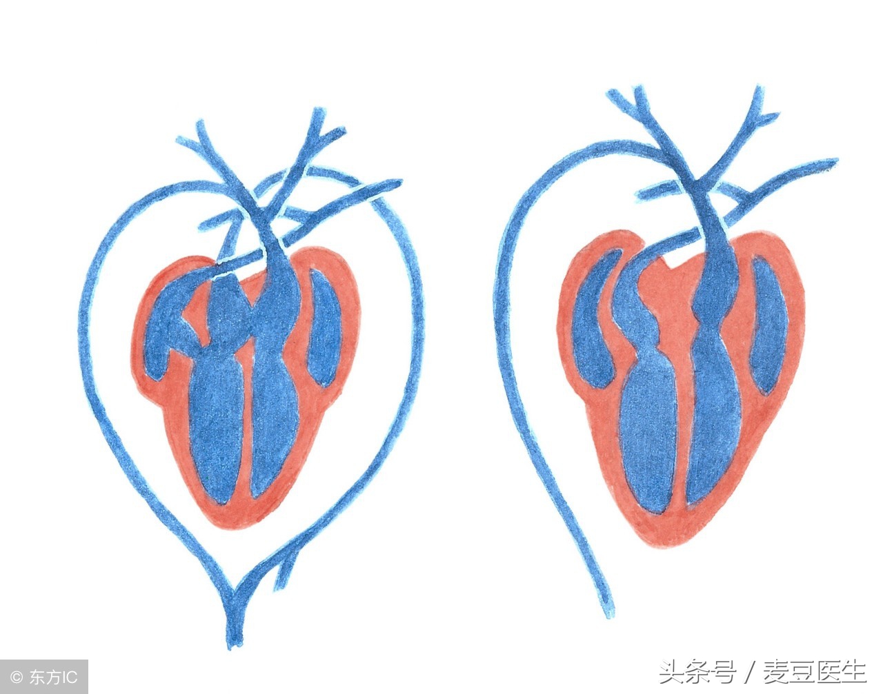如何解决孩子的心病,儿童先心病最佳治疗方案