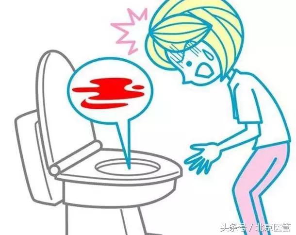 无痛胃肠镜检查前后注意事项,做了无痛胃肠镜后注意事项有哪些