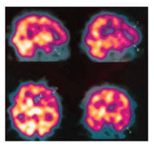 阴茎纹身还有这用处？医生应该见识的22个奇葩病例