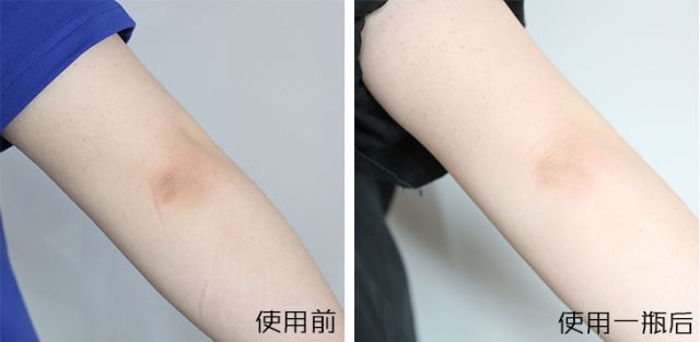 PP、腋下、手肘、三角区发黑暗沉？日本女*爱性**用好物，抹一抹，4周白嫩如少女！