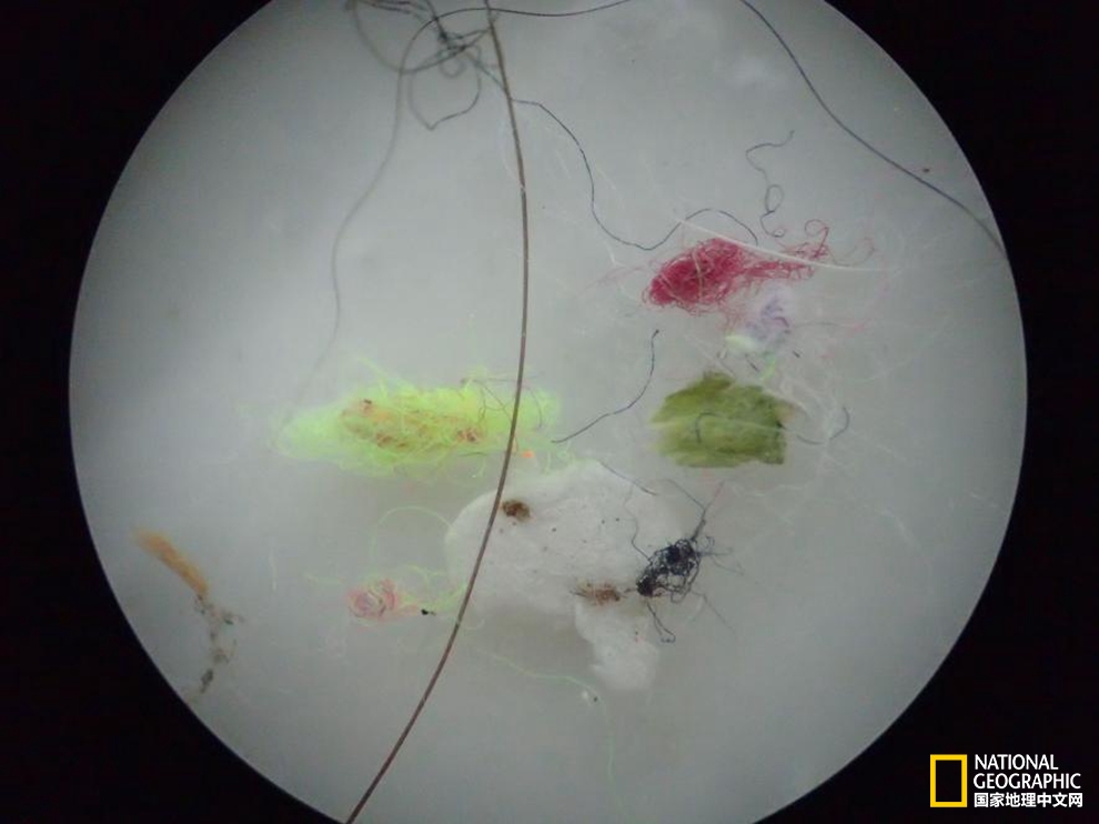 为啥人身体里有虫,总觉得自己体内有虫