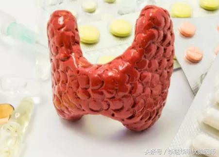 一招解决甲亢甲减,甲亢引起的肥胖怎么减肥