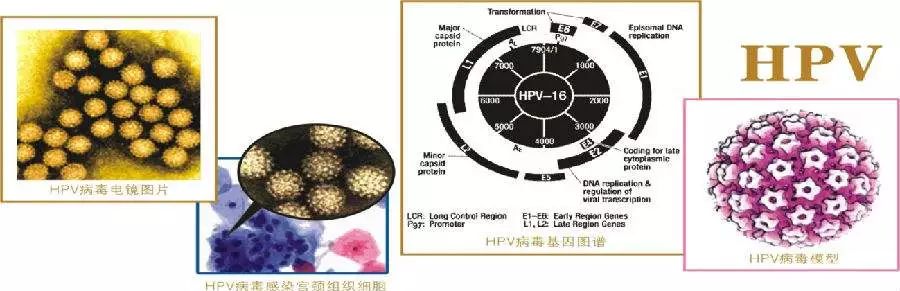 微生态失衡是不是就是宫颈癌,微生态正常和宫颈癌有关系吗