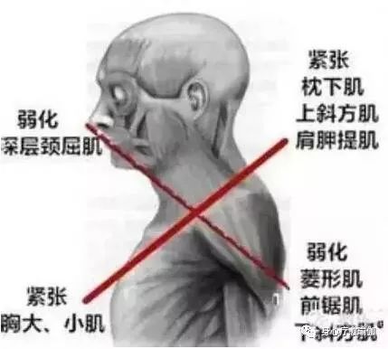 脚趾头无法弯曲怎么回事,脚趾不受控制是什么原因