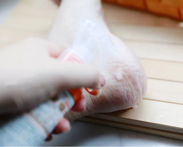 擦掉一张皮，双脚换皮术！死皮、老茧一喷就没，15秒还原嫩白玉足！