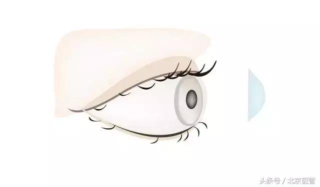 小孩近视去视力矫正中心有用吗,同仁医院看近视眼全过程