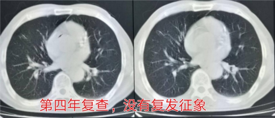 治疗癌症的靶向药能不能停,靶向治疗药物任何癌症都可以吃吗