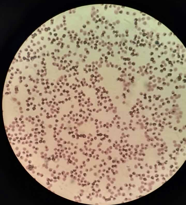 山羊寄生虫病症状,山羊癞病怎么治