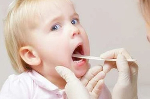 化脓性扁桃体炎中药,化脓性扁桃体炎白色脓点怎样处理