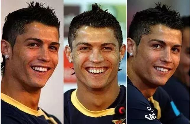 c罗容貌的变化,c罗整牙颜值变化