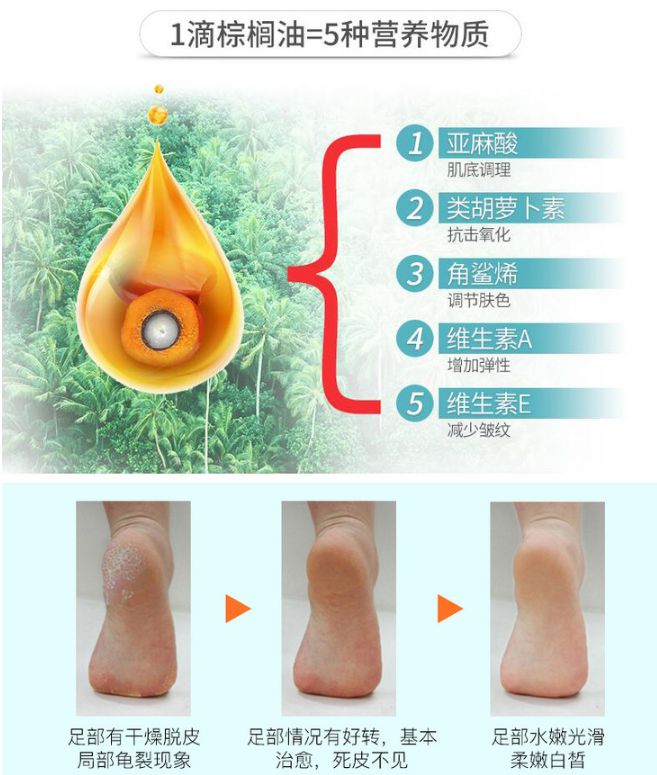 脚气脚臭有救了！有了这块韩国嫩足皂，轻轻一洗，杀菌治脚气，告别瘙痒，连死皮都不见了