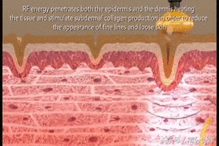顽固性易胖体质怎么瘦下去,145斤易胖体质能瘦下来吗