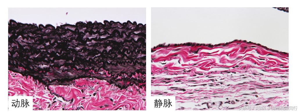 静脉曲张郑大一附院看哪个科,郑大一附院硬化剂治疗静脉曲张