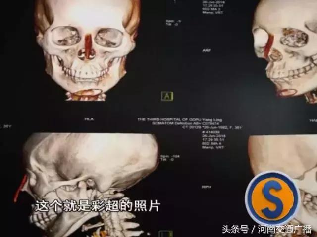 女子在整容医院整容失败当场死亡,整容失败女子医院讨说法被阻拦