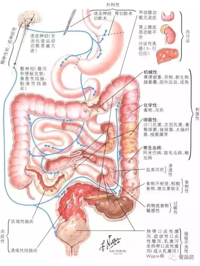 急性腹泻在家怎么处理,急性腹泻吃蒙脱石散