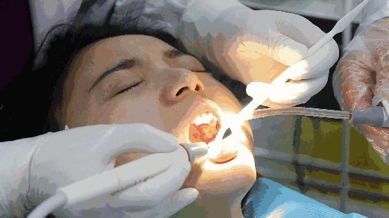 日本牙膏修复牙洞是真的吗,为什么日本人牙那么白