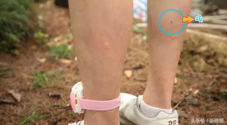 网红测评驱蚊的东西,打假测评达人驱蚊神器