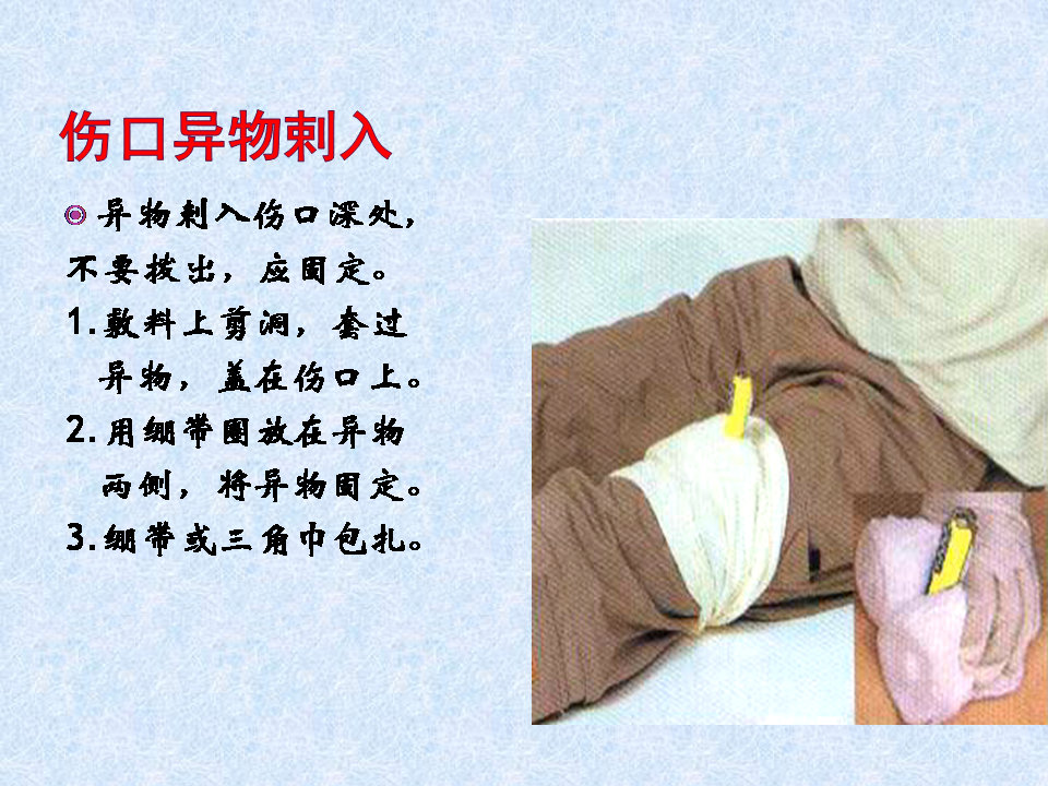 换药和拆线操作流程视频,换药拆线操作视频