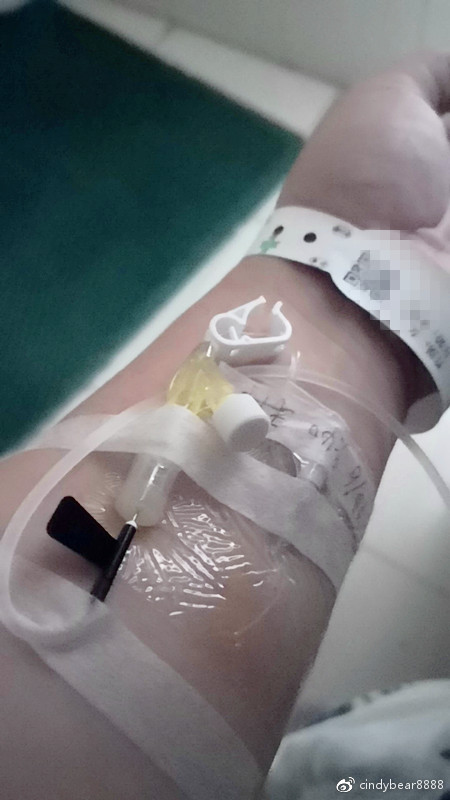 动画演示子宫全切术,动画演示切子宫手术