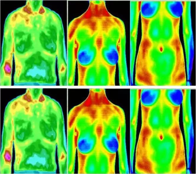 这个仪器好神奇：红黄蓝绿，扫描后身体病症成像仿佛是气象云图
