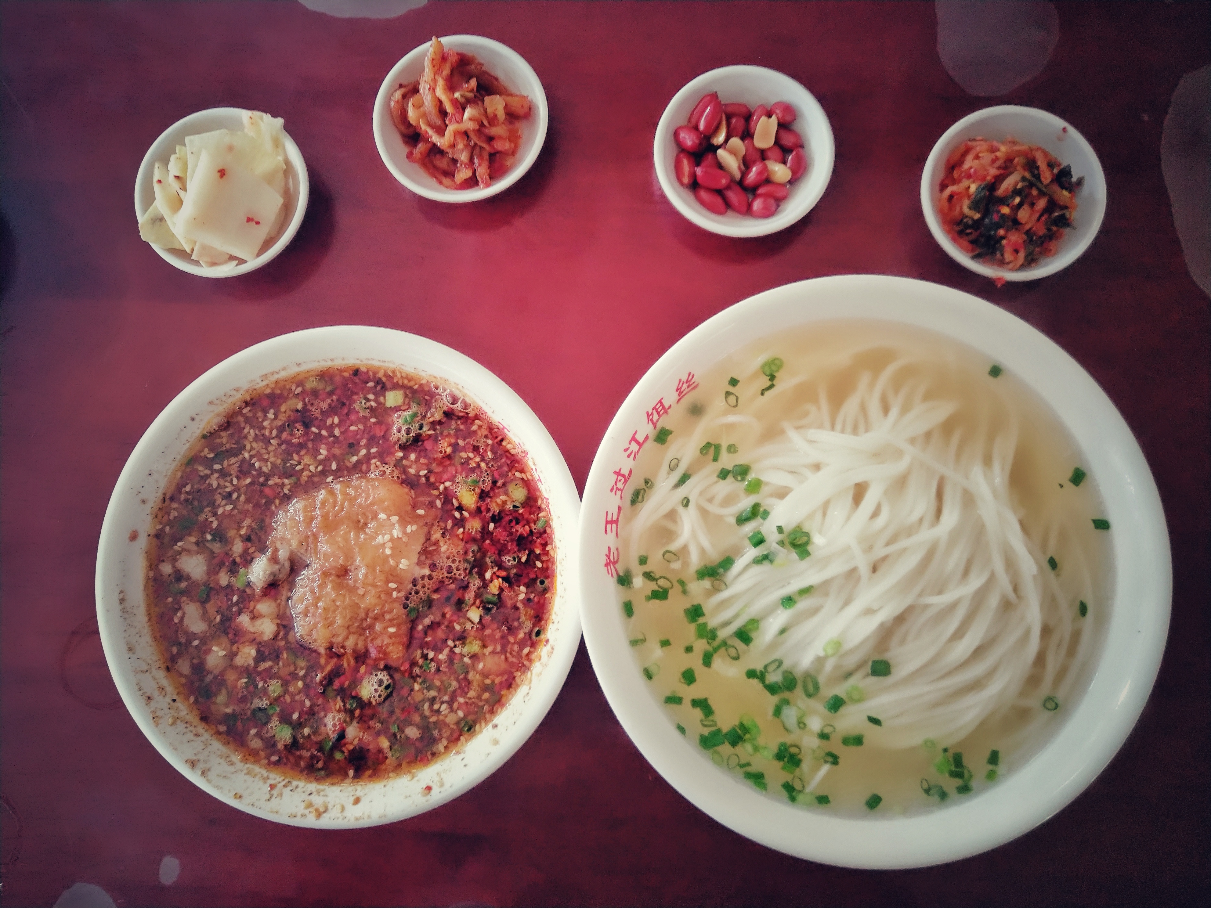 强迫症住院治疗一个月多少钱,强迫症患者要花多少钱