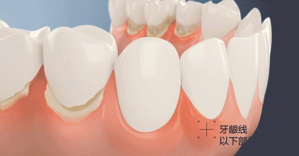 牙刷选得好牙医看得少｜2018年电动牙刷比较试验