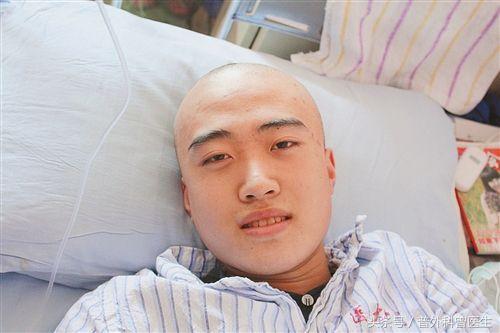 化疗脱发是不是不停药不长新头发,用奥沙利铂和替吉奥化疗会脱发吗