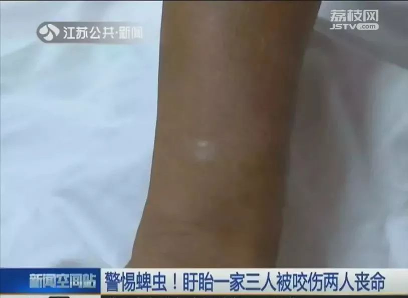 2岁男孩眼皮上突然冒出一个小黑点！医生：这东西会要命！眼下高发，别大意！