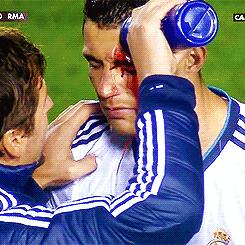 c罗受过最重的伤视频,c罗那些年欧冠