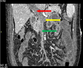你有一线生机，我必万分努力｜规培医师ICU轮转纪实