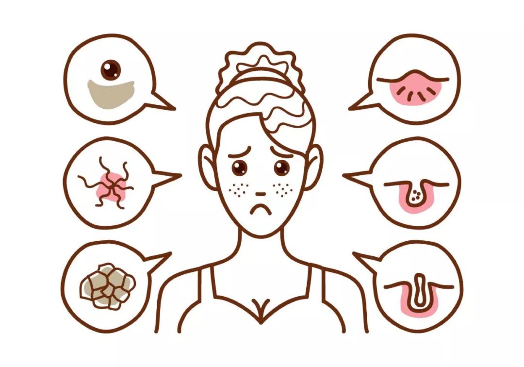 花1块5就能去掉闭口？亲测有效后我哭了……