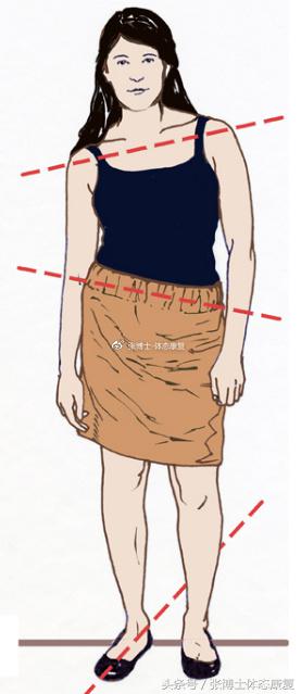 矫正长短腿去哪里矫正,体态矫正腿