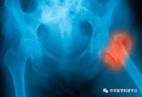 高血压停药的危害,高血压带来的危害有哪些