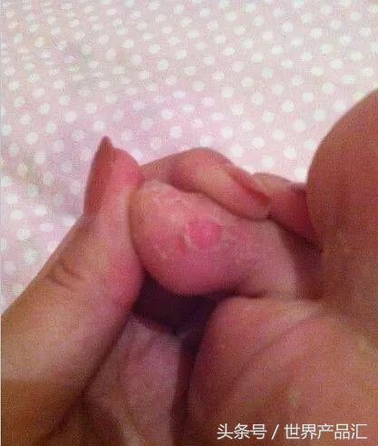 女明星一条小红书赚95万？狂推三无微商？