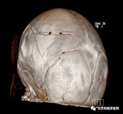 宝宝头部摔伤怎么办,小孩摔伤头部怎么办