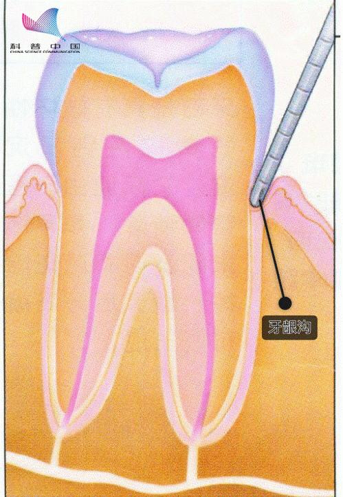 看牙太贵还不是因为你怕遭罪,不整牙有必要买冲牙器吗