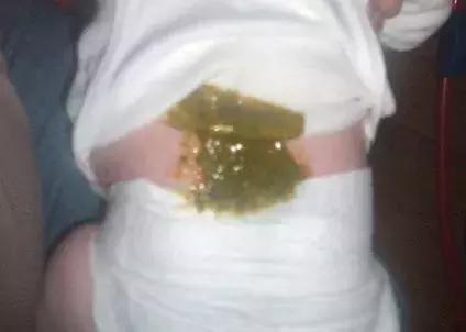 宝宝腹泻的原因和护理方法,宝宝腹泻原因及护理方法