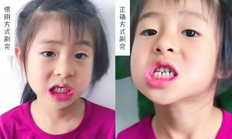 牙膏测评高露洁防蛀牙膏,牙膏推荐测评云南白药朗健