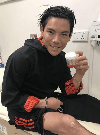 因拍戏受伤的十大明星,因拍戏而受伤的十大明星