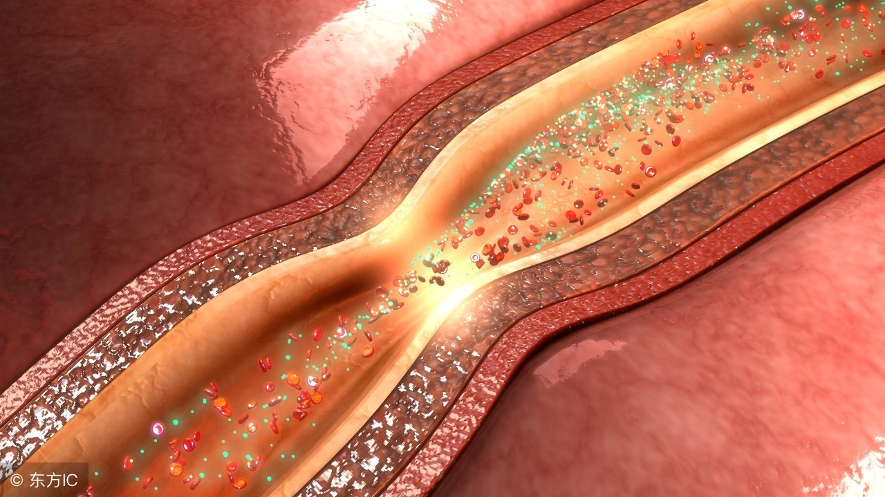 儿童得脑梗前兆有哪些症状,老人脑梗孩子该怎么办