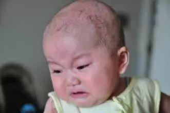 夏天要不要给宝宝剃头,夏天一定要给宝宝剃光头吗