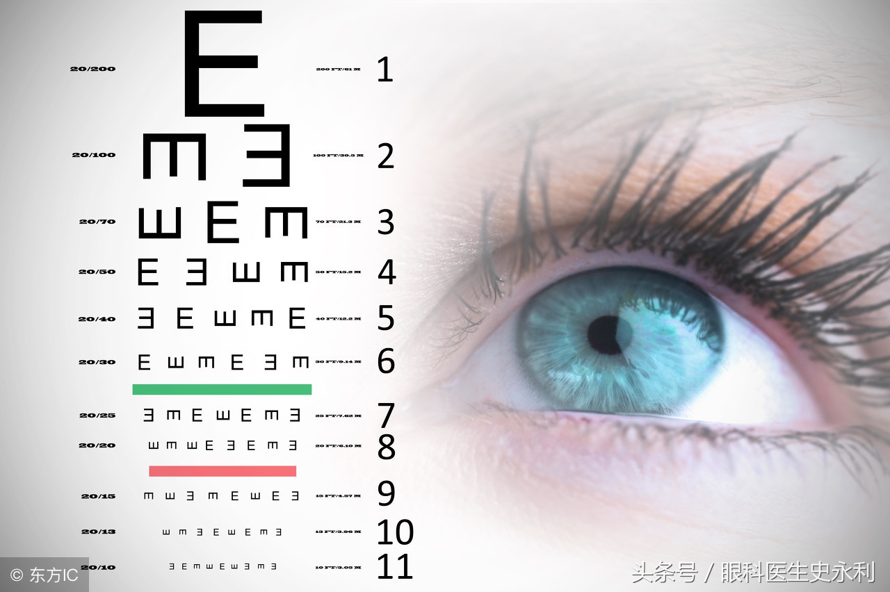 眼科医生为您科普近视眼手术的利与弊，想手术看完以后再决定！