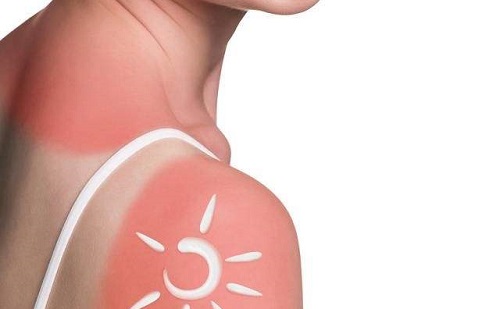 为什么去完海边会掉皮,从海边回来一直掉皮怎么解决