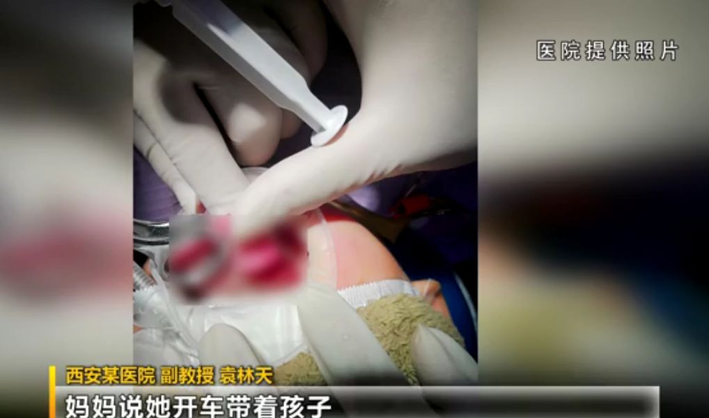 开车时一回头，1岁儿子满嘴是血，舌头竟然……开车这个错误不能再犯了！