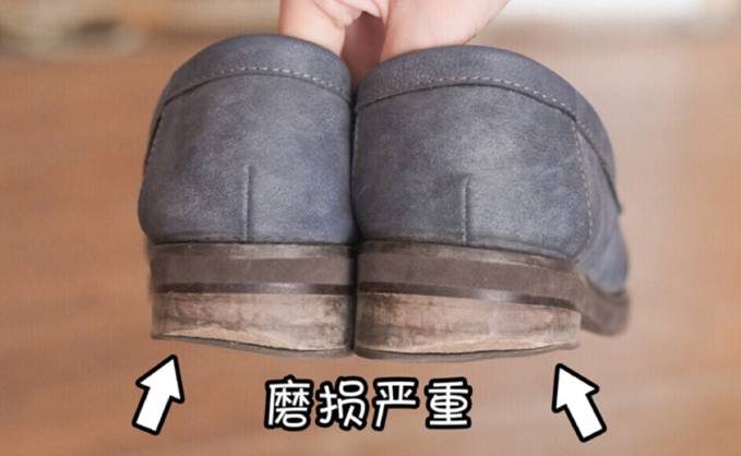 如何矫正足外翻和o型腿,走路足内翻怎么矫正