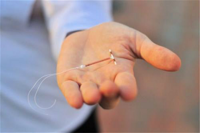 易怀孕体质不想上环怎么办,易孕体质怎样不怀孕呢